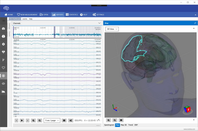 Brain View Neuralscan qEEG