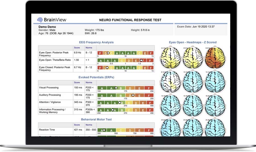 Neuralscan Technology